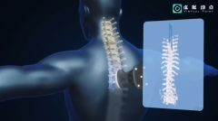 利亚德·虚拟动点OptiTrack开创3D超声成像在脊柱诊断中的应用